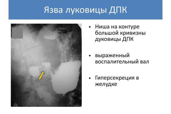 Как зайти на кракен через браузер